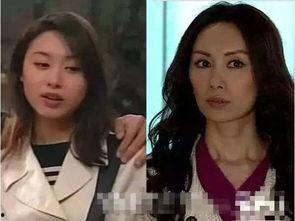 面部凹陷明星,揭秘独特魅力背后的故事